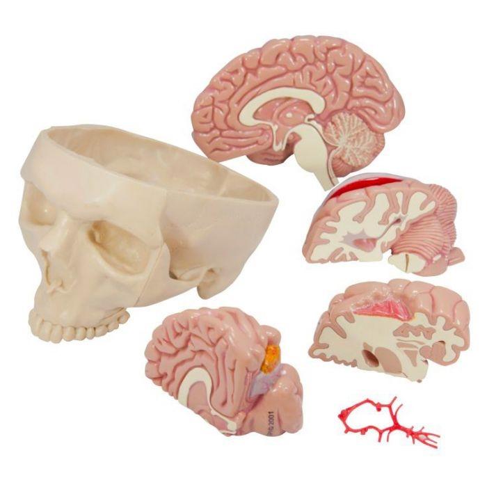1. GPI Skull Models