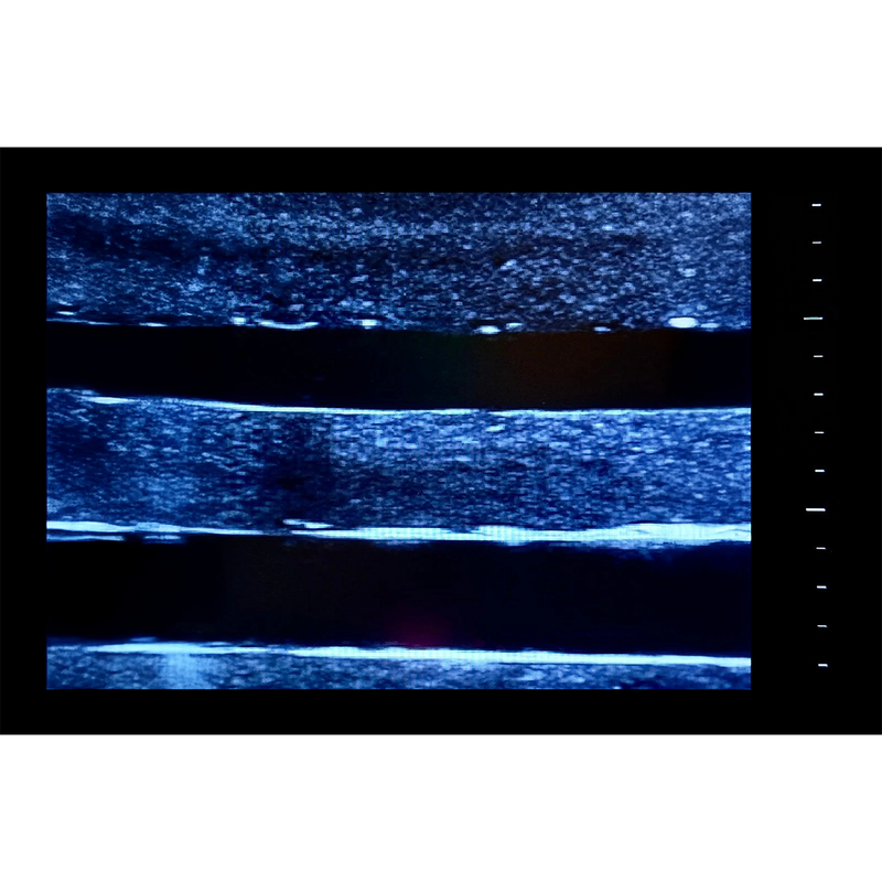 Ultrasound Simulator with 4 Central Lines
