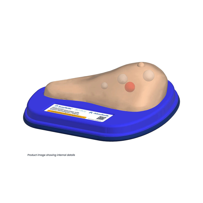 Ultrasound Simulator with Breast Pathologies/Biopsy