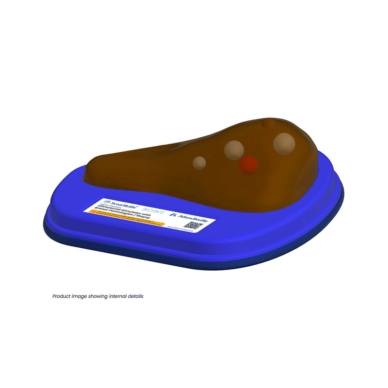 Ultrasound Simulator with Breast Pathologies/Biopsy