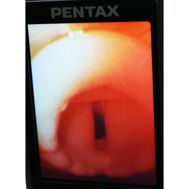 Difficult Airway Management Training Simulator