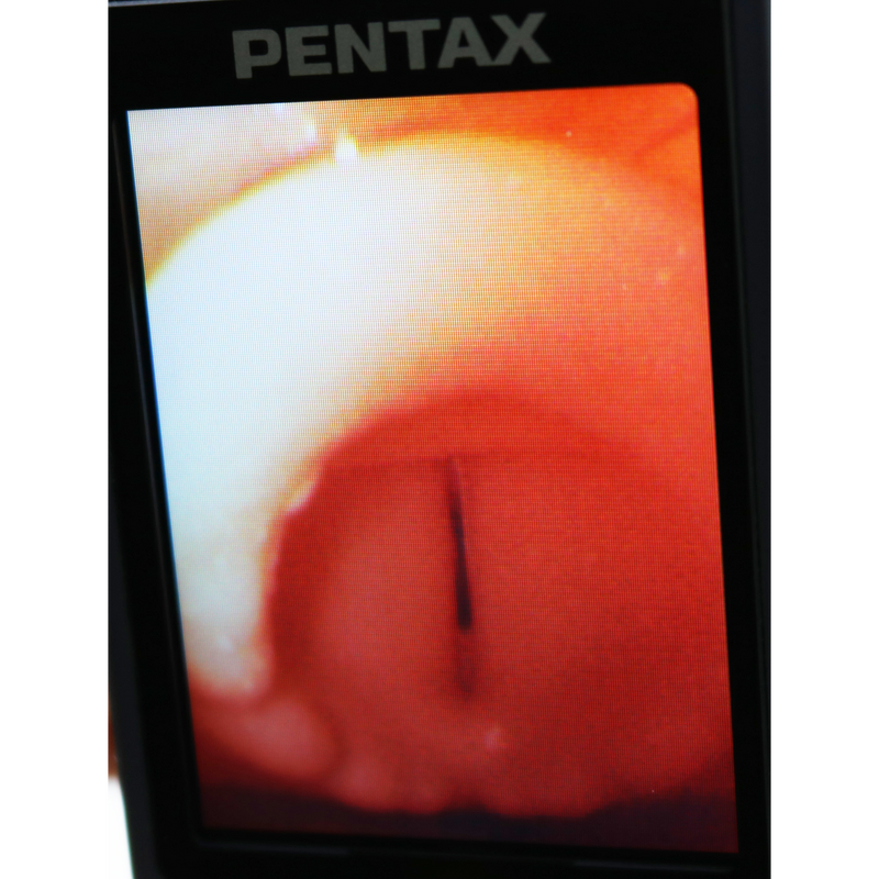 Difficult Airway Management Training Simulator