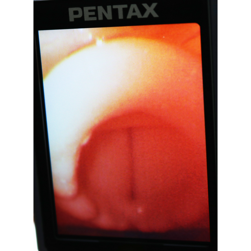 Difficult Airway Management Training Simulator