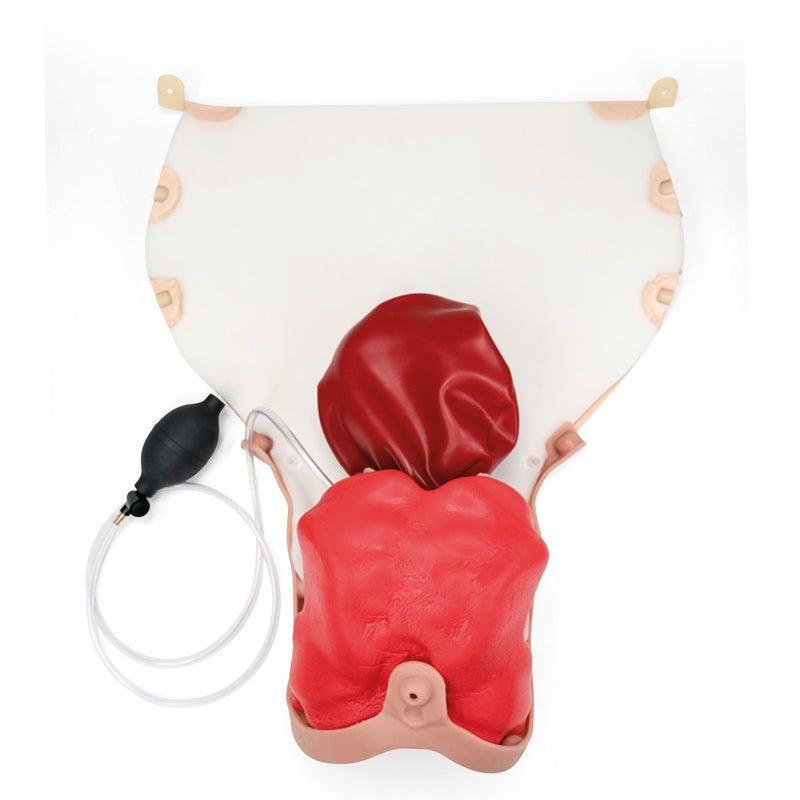 Postpartum Hemorrhage Module