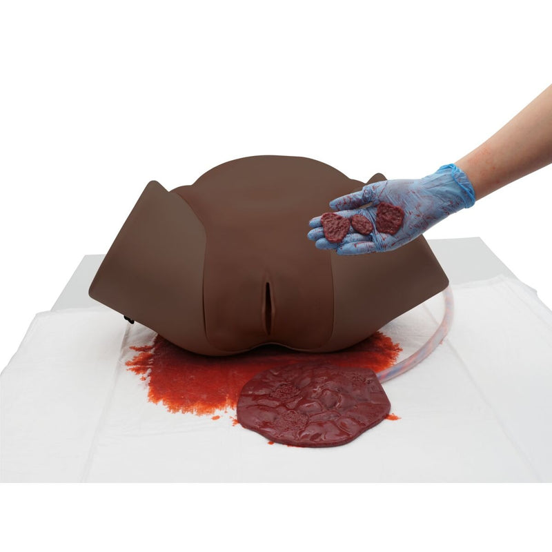 Postpartum Hemorrhage Module for Birth Simulator P90, Dark Skin