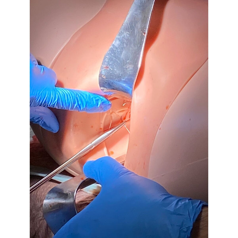 Postpartum Hemorrhage Module for Birth Simulator P90, Light Skin
