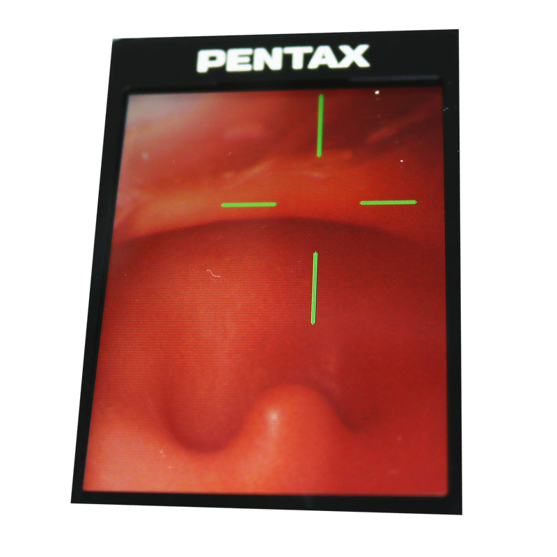 Difficult Airway Management Training Simulator