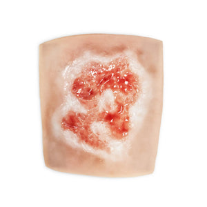 Acid and Chemical Burn Sleeve for Medical Training Simulation