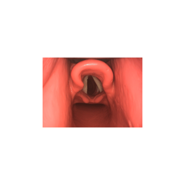 TruBaby X Lite Pediatric Basic Skills Trainer