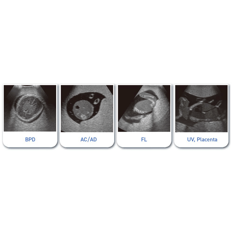 Fetus Ultrasound Examination Phantom SPACE FAN-ST HEART