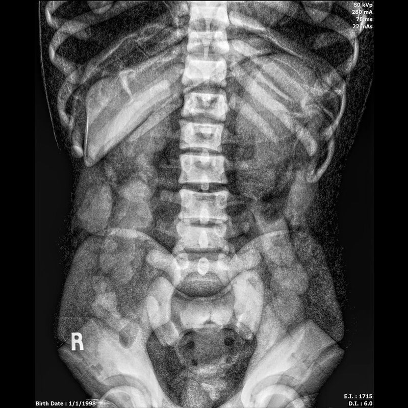Adult Full Body for X-Ray Positioning and Imaging