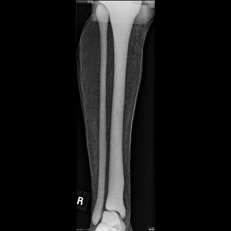 Adult Full Body for X-Ray Positioning and Imaging