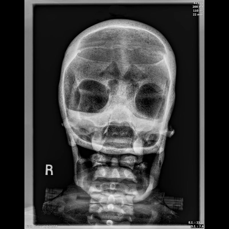 Adult Full Body for X-Ray Positioning and Imaging