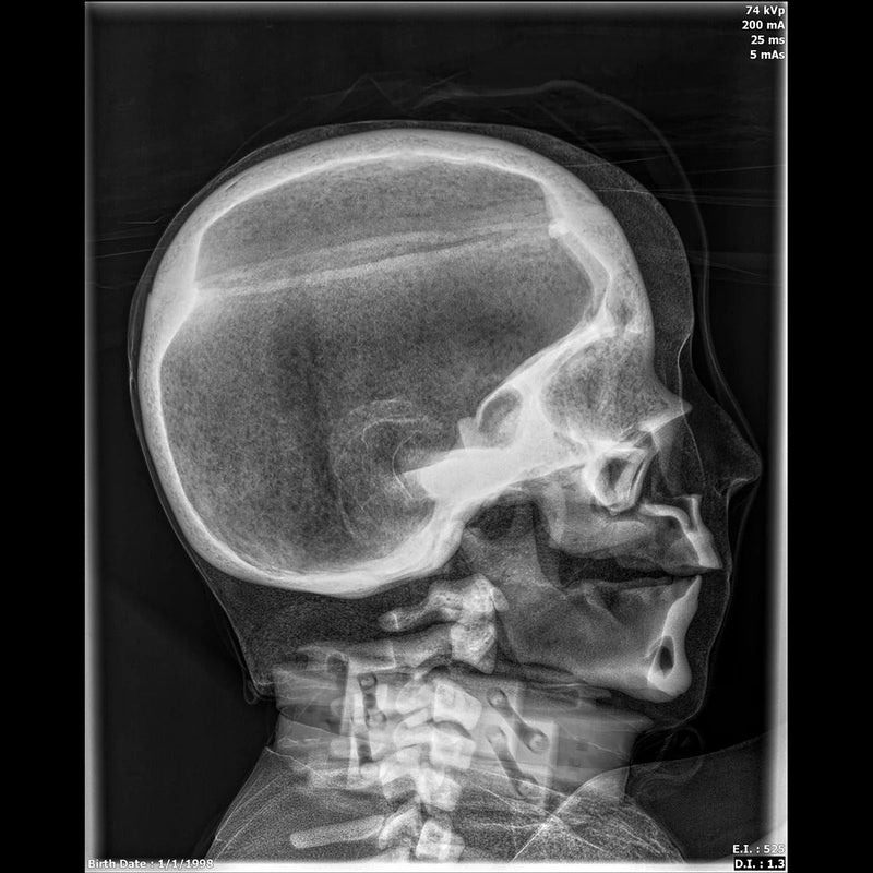 Adult Full Body for X-Ray Positioning and Imaging