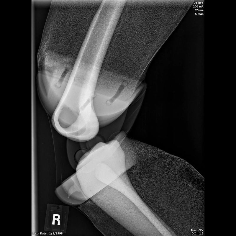 Adult Full Body for X-Ray Positioning and Imaging