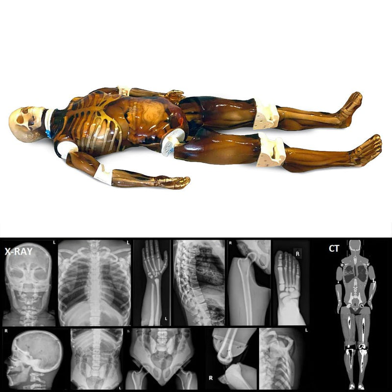 Xray Human Body X Ray: Purpose, Procedure, And Risks