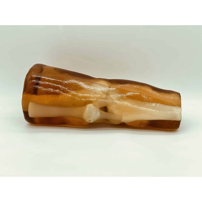 Adult Knee X-Ray, CT Scan, Ultrasound and MRI - Ligaments/Tendons