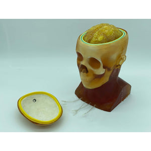 Advanced Adult Head Phantom for X-Ray CT, Ultrasound and MRI