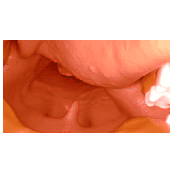 AirSim Difficult Airway Model