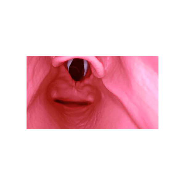 AirSim Difficult Airway Model