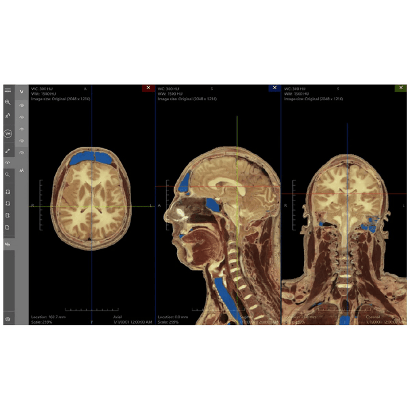 Anatomy Table, Interactive Anatomy Learning Platform