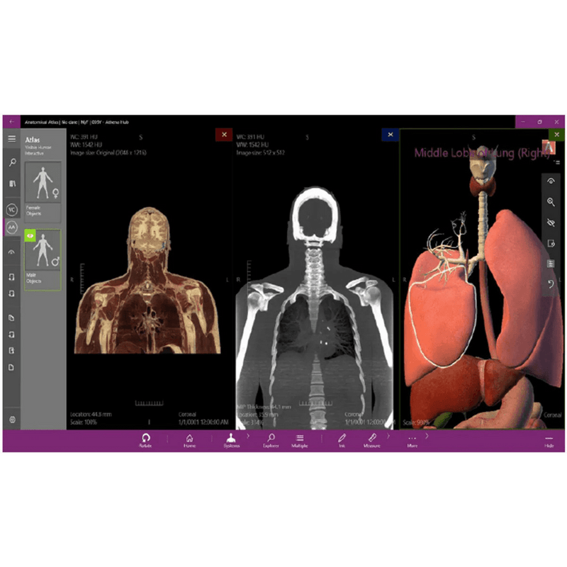 Anatomy Table, Interactive Anatomy Learning Platform