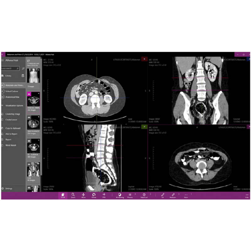 Anatomy Table, Interactive Anatomy Learning Platform