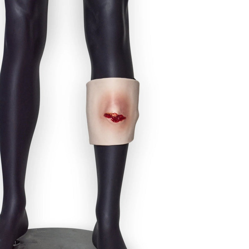 Broken Tibia Trauma