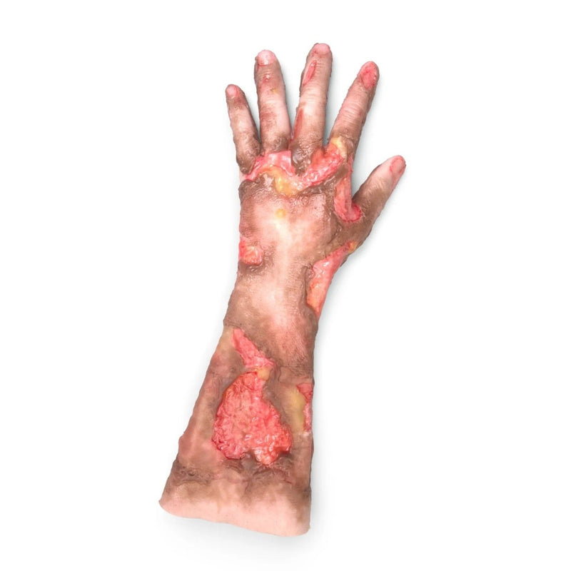 Burned Arm Long