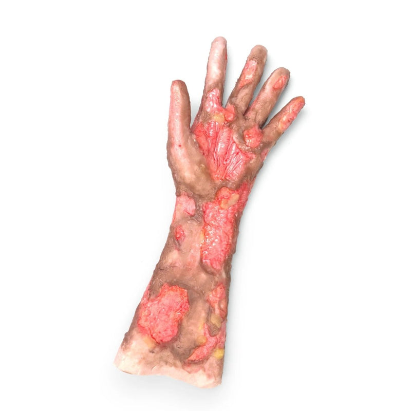Burned Arm Long