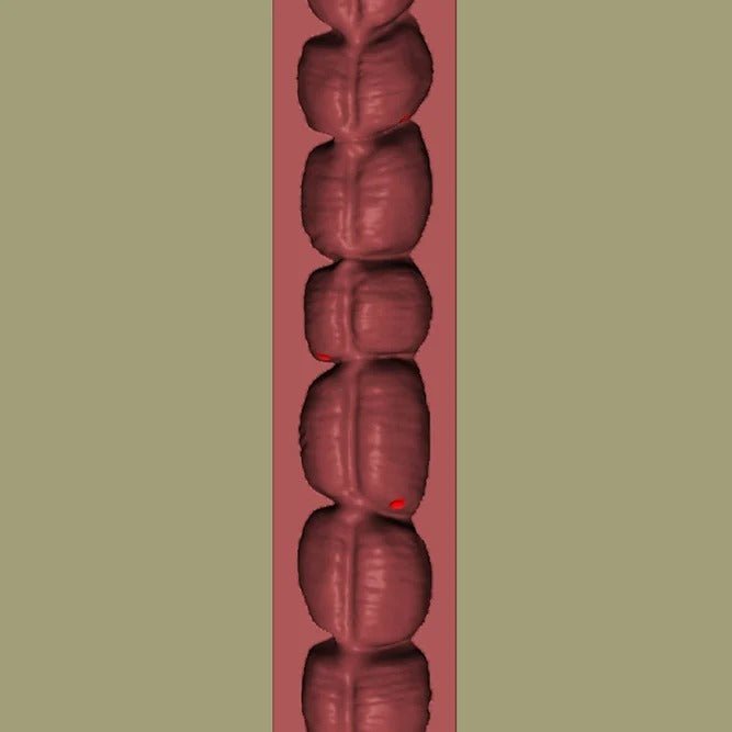 Colon Endoscopy Trainer with Flat Polyps