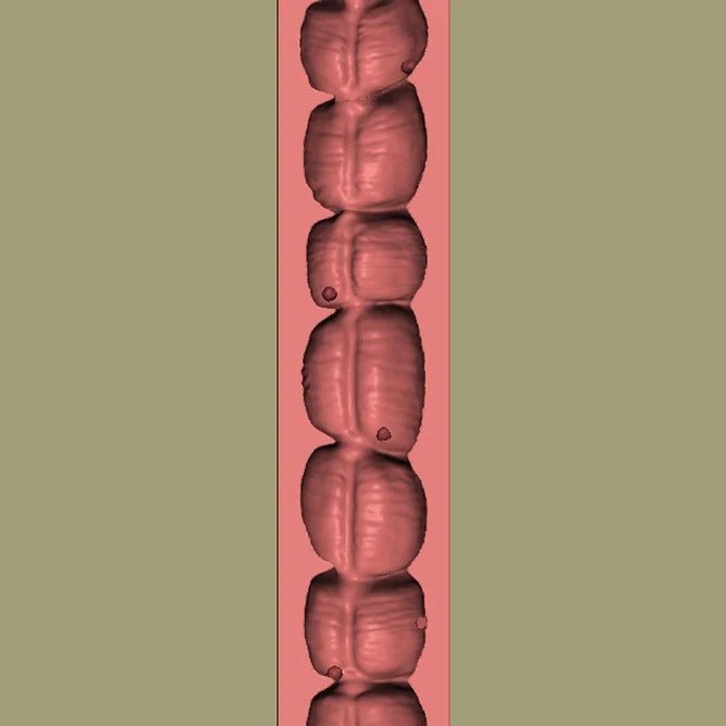 Colon Endoscopy Trainer with Raised Polyps