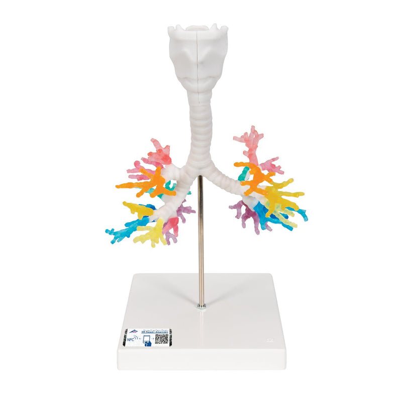 CT Bronchial Tree with Larynx Model