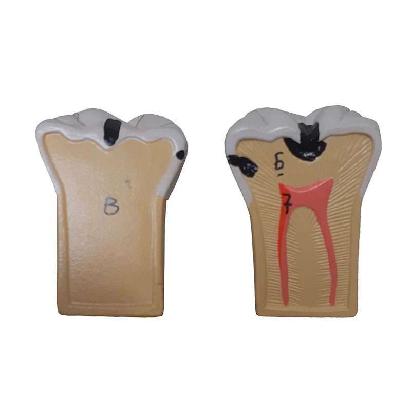 Dental Morphology Model, 4X Enlarged, 7 Parts