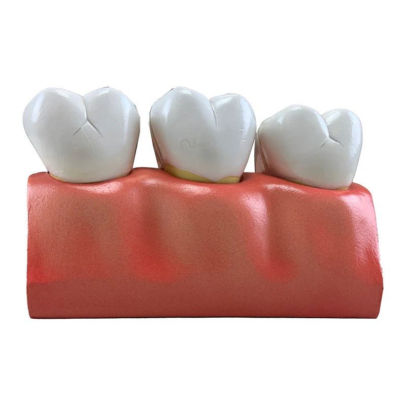 Dental Morphology Model, 4X Enlarged, 7 Parts