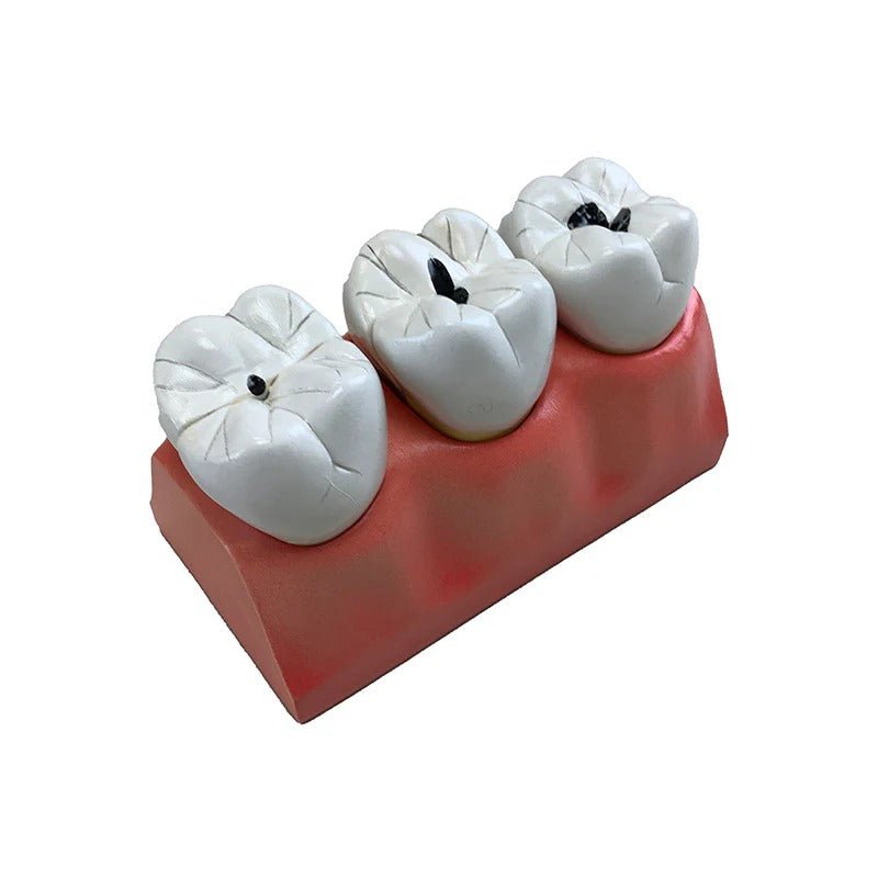 Dental Morphology Model, 4X Enlarged, 7 Parts