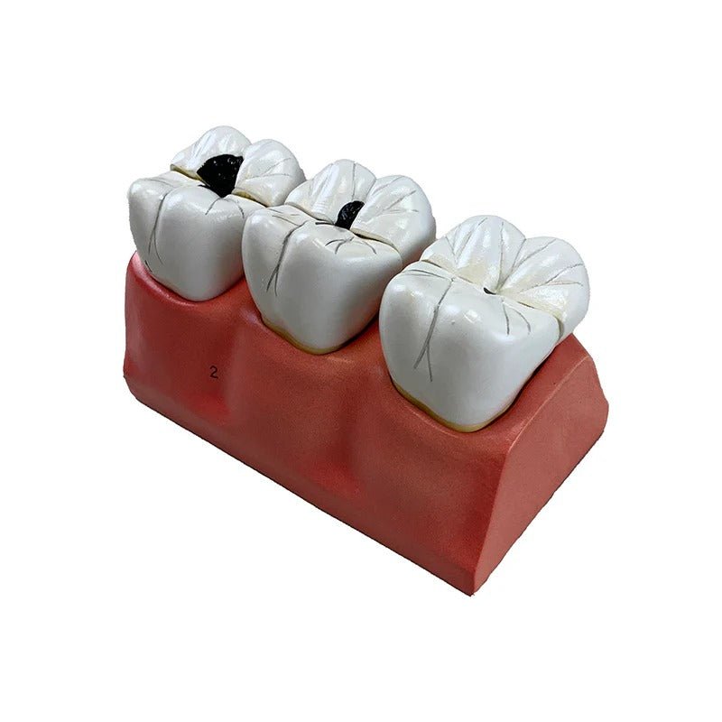 Dental Morphology Model, 4X Enlarged, 7 Parts
