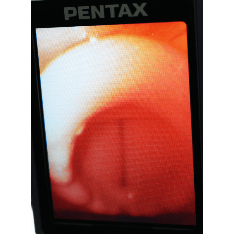 Difficult Airway Management Training Simulator