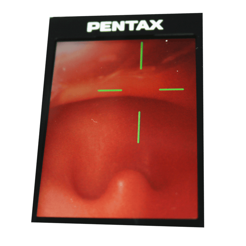 Difficult Airway Management Training Simulator