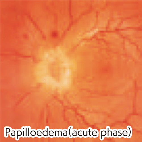 Digital EYE Examination Simulator (2 Steps)