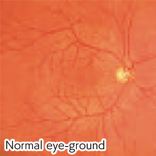 Digital EYE Examination Simulator (2 Steps)