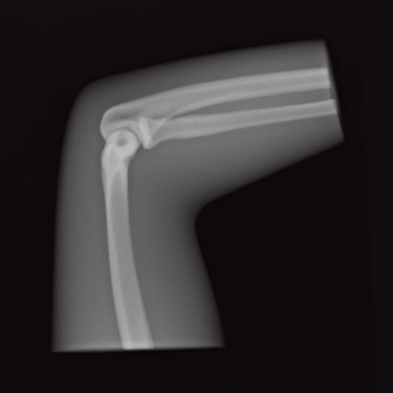 Elbow Phantom 90° Flexion