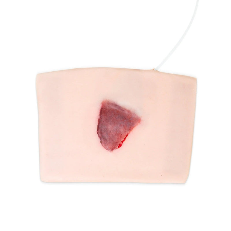 Elderly Skin Tear