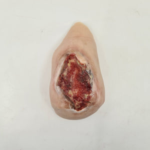 Electrical Burn Heel