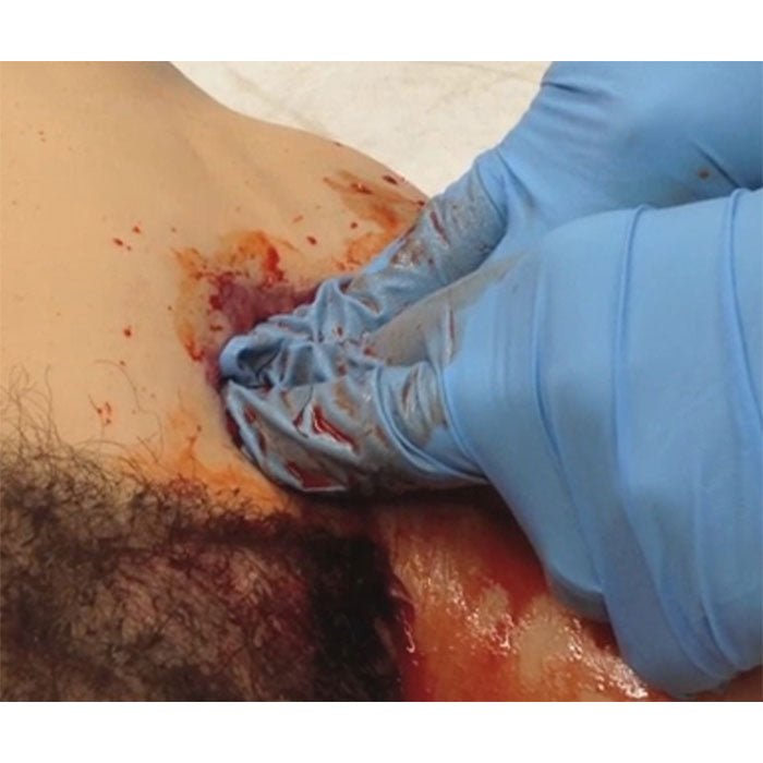 EMITT - Active Shooter Lower