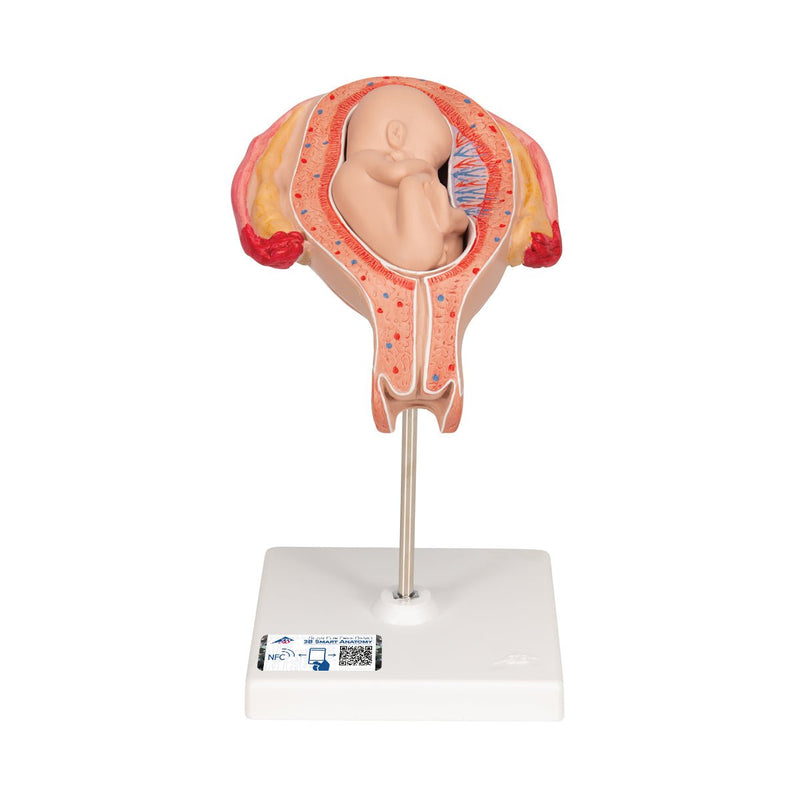Fetus, Month 5, Breech Position
