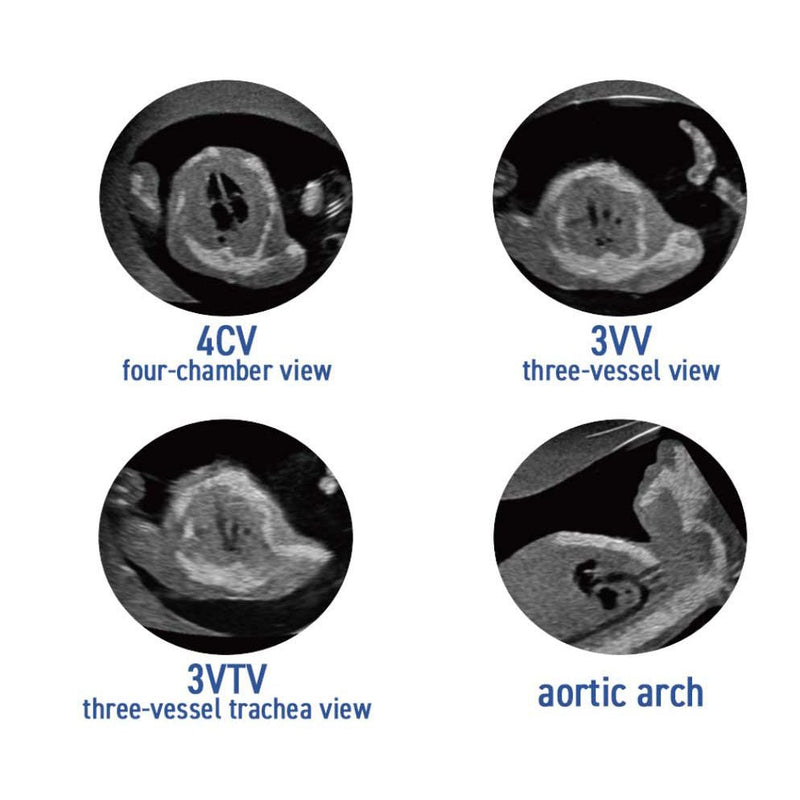 Fetus Ultrasound Examination Phantom SPACE FAN-ST HEART