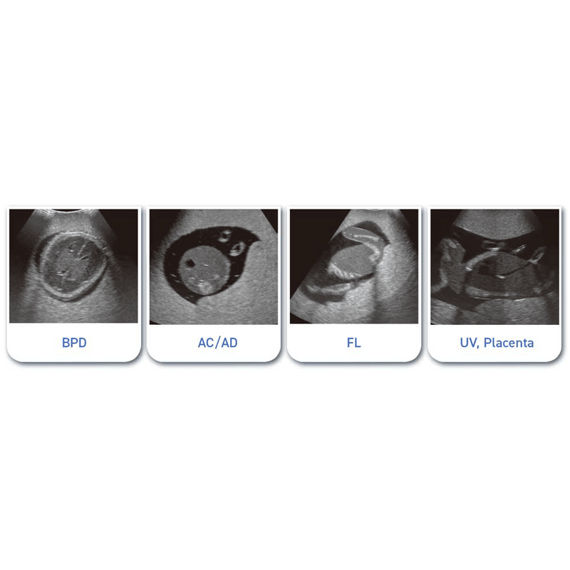 Fetus Ultrasound Examination Phantom SPACE FAN-ST HEART