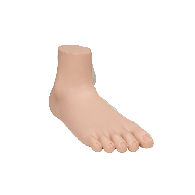 Flat Foot (Pes Panus)