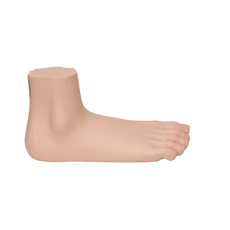 Flat Foot (Pes Panus)